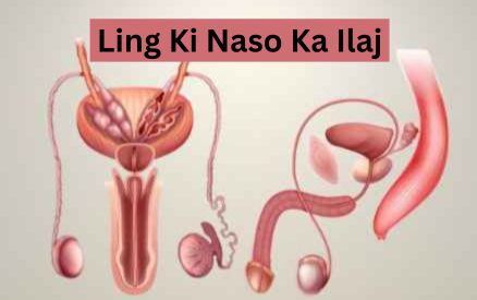 Ling Ki Naso Ka Ilaj: Naso Ki Kamzori, Dhilapan, Timing aur Stamina Ka Powerful Ayurvedic Solution